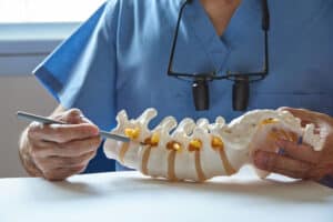 Doctor holding a model of the lumbar spine
