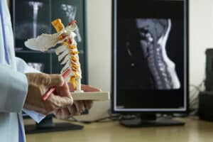 Spine model and x-ray for planning minimally invasive spine surgery