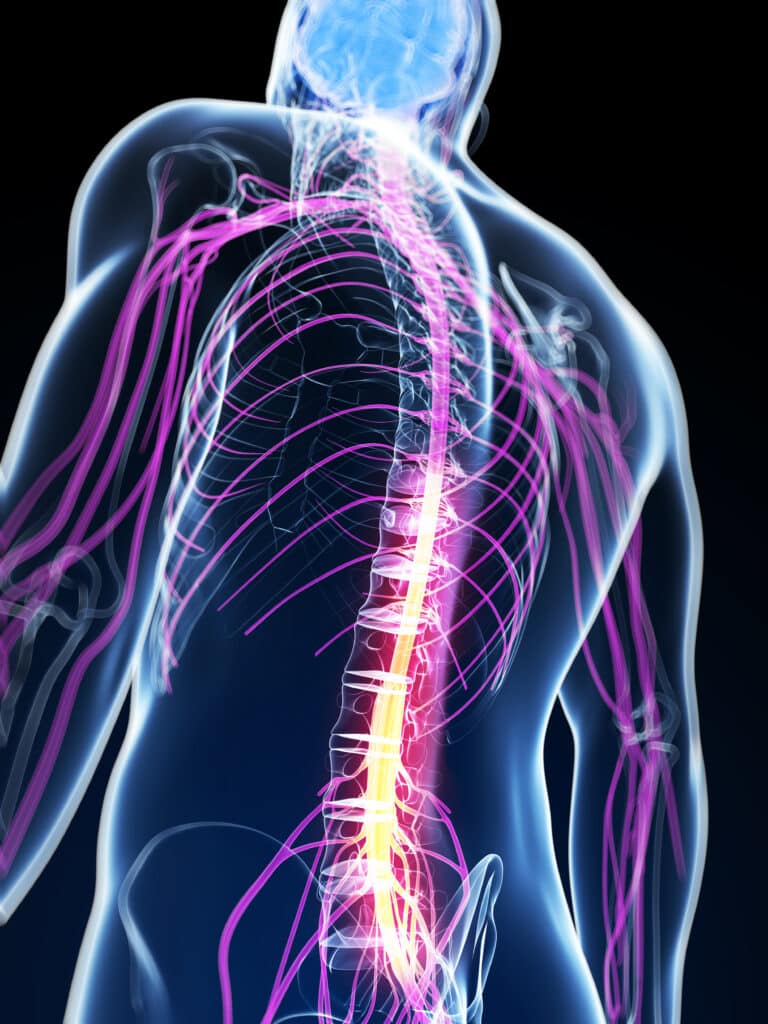 Lumbar Fusion in Sugarland, TX